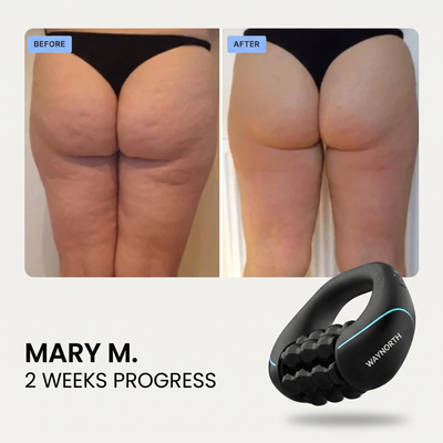 WayNorth fascia massager
